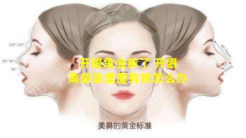 开眼角会脓了 开眼角感染里面有脓怎么办